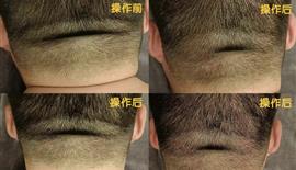 客户反馈